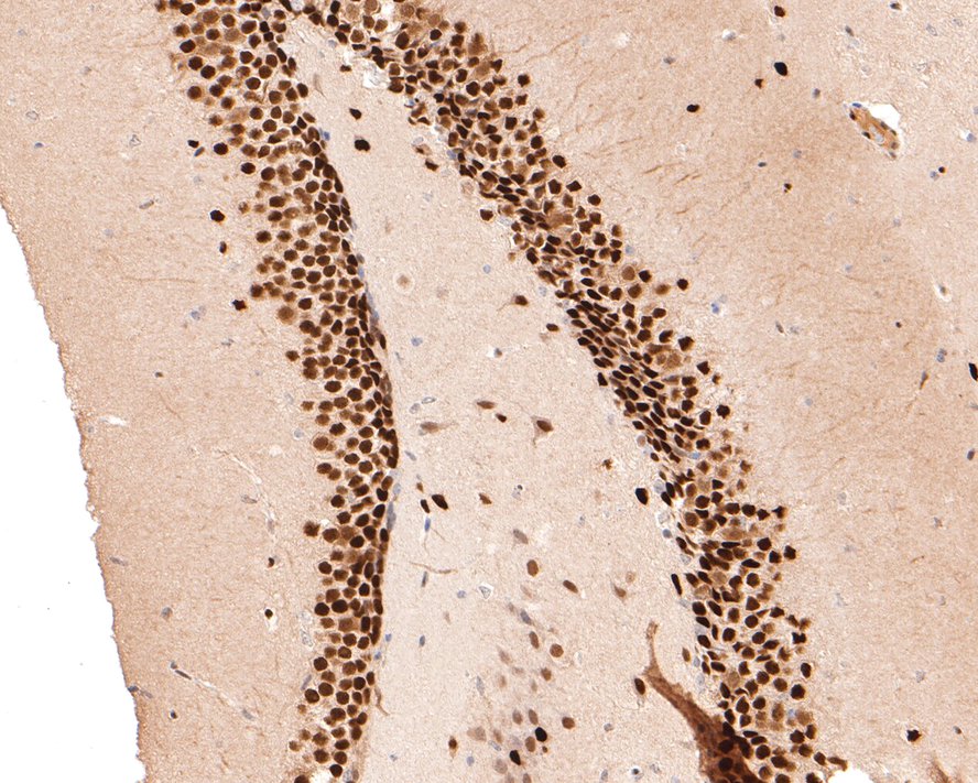 Immunohistochemical analysis of paraffin-embedded mouse hippocampus tissue with Rabbit anti-MEF2A antibody (ET1704-58) at 1/500 dilution.<br />
<br />
The section was pre-treated using heat mediated antigen retrieval with sodium citrate buffer (pH 6.0) for 2 minutes. The tissues were blocked in 1% BSA for 20 minutes at room temperature, washed with ddH2O and PBS, and then probed with the primary antibody (ET1704-58) at 1/500 dilution for 1 hour at room temperature. The detection was performed using an HRP conjugated compact polymer system. DAB was used as the chromogen. Tissues were counterstained with hematoxylin and mounted with DPX.