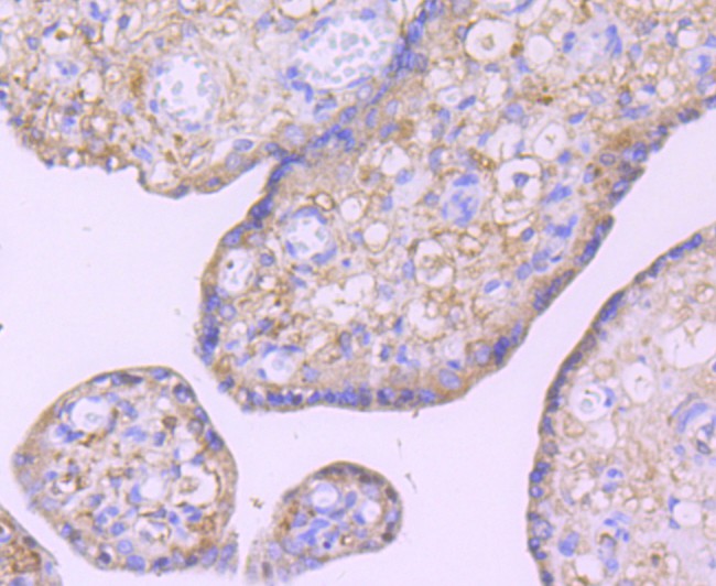Immunohistochemical analysis of paraffin-embedded mouse brain tissue using anti-Glucose Transporter GLUT3 antibody. The section was pre-treated using heat mediated antigen retrieval with Tris-EDTA buffer (pH 8.0-8.4) for 20 minutes.The tissues were blocked in 5% BSA for 30 minutes at room temperature, washed with ddH2O and PBS, and then probed with the primary antibody (ET1704-59, 1/50) for 30 minutes at room temperature. The detection was performed using an HRP conjugated compact polymer system. DAB was used as the chromogen. Tissues were counterstained with hematoxylin and mounted with DPX.
