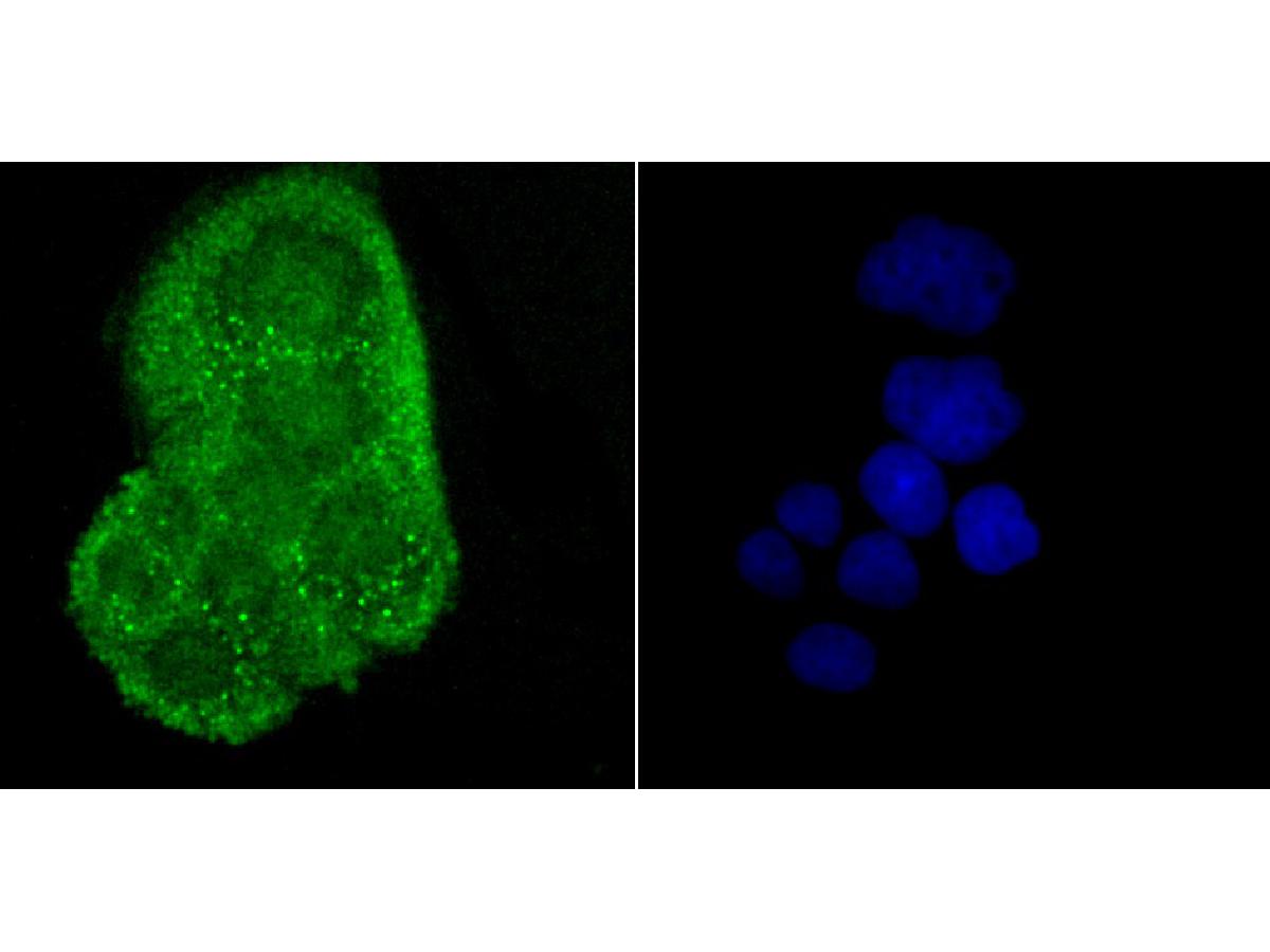 ICC staining of Alpha B Crystallin in Hela cells (green). Formalin fixed cells were permeabilized with 0.1% Triton X-100 in TBS for 10 minutes at room temperature and blocked with 10% negative goat serum for 15 minutes at room temperature. Cells were probed with the primary antibody (ET1704-60, 1/50) for 1 hour at room temperature, washed with PBS. Alexa Fluor®488 conjugate-Goat anti-Rabbit IgG was used as the secondary antibody at 1/1,000 dilution. The nuclear counter stain is DAPI (blue).