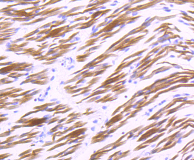 Immunohistochemical analysis of paraffin-embedded human embryonic skeletal muscle tissue using anti-Alpha B Crystallin antibody. The section was pre-treated using heat mediated antigen retrieval with Tris-EDTA buffer (pH 9.0) for 20 minutes.The tissues were blocked in 5% BSA for 30 minutes at room temperature, washed with ddH2O and PBS, and then probed with the primary antibody (ET1704-60, 1/50) for 30 minutes at room temperature. The detection was performed using an HRP conjugated compact polymer system. DAB was used as the chromogen. Tissues were counterstained with hematoxylin and mounted with DPX.