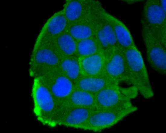ICC staining of smooth muscle Myosin heavy chain 11 in Hela cells (green). Formalin fixed cells were permeabilized with 0.1% Triton X-100 in TBS for 10 minutes at room temperature and blocked with 1% Blocker BSA for 15 minutes at room temperature. Cells were probed with the primary antibody (ET1704-61, 1/50) for 1 hour at room temperature, washed with PBS. Alexa Fluor®488 Goat anti-Rabbit IgG was used as the secondary antibody at 1/1,000 dilution. The nuclear counter stain is DAPI (blue).