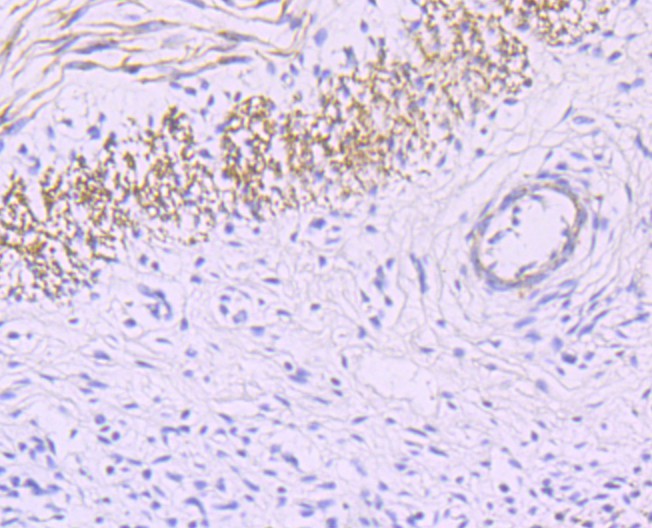 Immunohistochemical analysis of paraffin-embedded human jejunum tissue using anti-smooth muscle Myosin heavy chain 11 antibody. The section was pre-treated using heat mediated antigen retrieval with Tris-EDTA buffer (pH 8.0-8.4) for 20 minutes.The tissues were blocked in 5% BSA for 30 minutes at room temperature, washed with ddH2O and PBS, and then probed with the primary antibody (ET1704-61, 1/50) for 30 minutes at room temperature. The detection was performed using an HRP conjugated compact polymer system. DAB was used as the chromogen. Tissues were counterstained with hematoxylin and mounted with DPX.