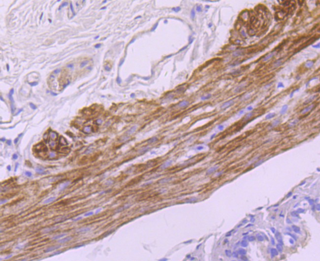 Immunohistochemical analysis of paraffin-embedded rat trachea tissue using anti-smooth muscle Myosin heavy chain 11 antibody. The section was pre-treated using heat mediated antigen retrieval with Tris-EDTA buffer (pH 8.0-8.4) for 20 minutes.The tissues were blocked in 5% BSA for 30 minutes at room temperature, washed with ddH2O and PBS, and then probed with the primary antibody (ET1704-61, 1/50) for 30 minutes at room temperature. The detection was performed using an HRP conjugated compact polymer system. DAB was used as the chromogen. Tissues were counterstained with hematoxylin and mounted with DPX.