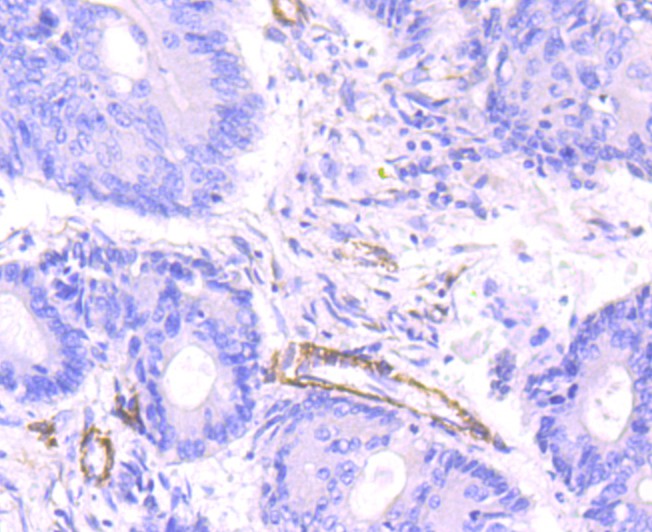 Immunohistochemical analysis of paraffin-embedded human colon tissue using anti-smooth muscle Myosin heavy chain 11 antibody. The section was pre-treated using heat mediated antigen retrieval with Tris-EDTA buffer (pH 8.0-8.4) for 20 minutes.The tissues were blocked in 5% BSA for 30 minutes at room temperature, washed with ddH2O and PBS, and then probed with the primary antibody (ET1704-61, 1/50) for 30 minutes at room temperature. The detection was performed using an HRP conjugated compact polymer system. DAB was used as the chromogen. Tissues were counterstained with hematoxylin and mounted with DPX.