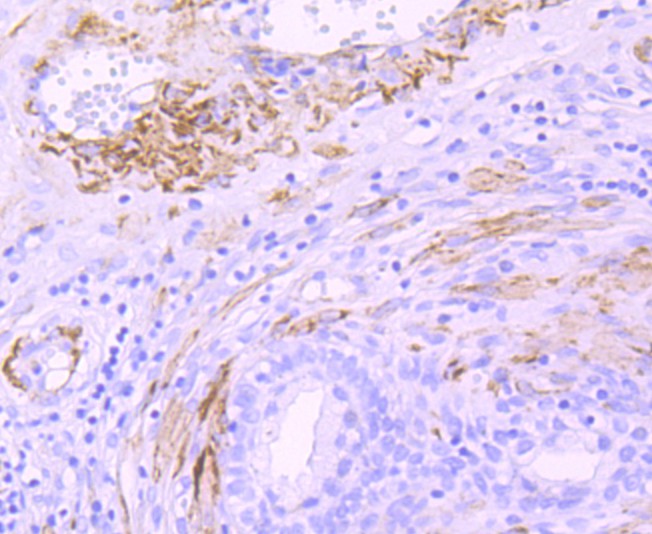 Immunohistochemical analysis of paraffin-embedded human prostate tissue using anti-smooth muscle Myosin heavy chain 11 antibody. The section was pre-treated using heat mediated antigen retrieval with Tris-EDTA buffer (pH 8.0-8.4) for 20 minutes.The tissues were blocked in 5% BSA for 30 minutes at room temperature, washed with ddH2O and PBS, and then probed with the primary antibody (ET1704-61, 1/50) for 30 minutes at room temperature. The detection was performed using an HRP conjugated compact polymer system. DAB was used as the chromogen. Tissues were counterstained with hematoxylin and mounted with DPX.