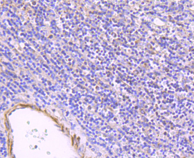 Immunohistochemical analysis of paraffin-embedded human spleen tissue using anti-ULK1 antibody. The section was pre-treated using heat mediated antigen retrieval with Tris-EDTA buffer (pH 8.0-8.4) for 20 minutes.The tissues were blocked in 5% BSA for 30 minutes at room temperature, washed with ddH2O and PBS, and then probed with the primary antibody (ET1704-63, 1/50) for 30 minutes at room temperature. The detection was performed using an HRP conjugated compact polymer system. DAB was used as the chromogen. Tissues were counterstained with hematoxylin and mounted with DPX.