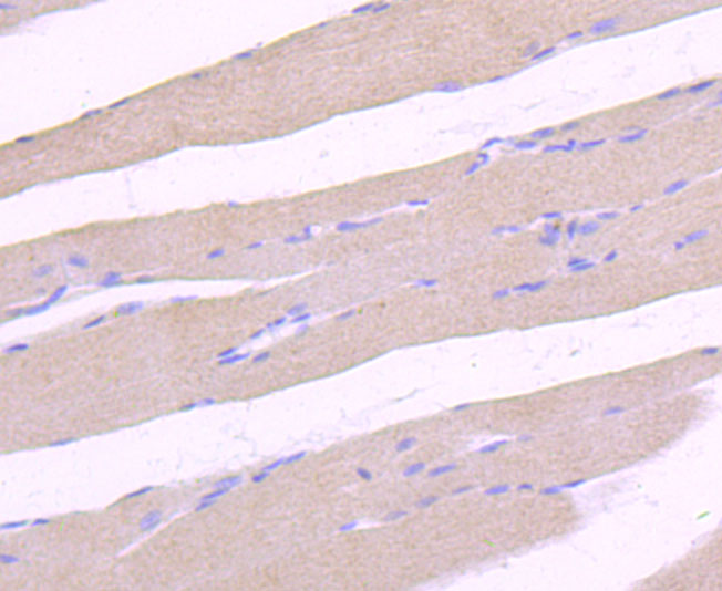 Immunohistochemical analysis of paraffin-embedded rat skeletal muscle tissue using anti-ULK1 antibody. The section was pre-treated using heat mediated antigen retrieval with Tris-EDTA buffer (pH 8.0-8.4) for 20 minutes.The tissues were blocked in 5% BSA for 30 minutes at room temperature, washed with ddH2O and PBS, and then probed with the primary antibody (ET1704-63, 1/50) for 30 minutes at room temperature. The detection was performed using an HRP conjugated compact polymer system. DAB was used as the chromogen. Tissues were counterstained with hematoxylin and mounted with DPX.