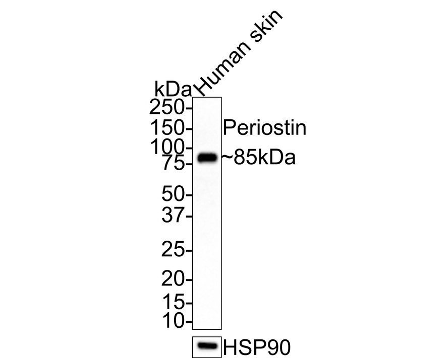Western blot analysis of Periostin on human skin tissue lysates with Rabbit anti-Periostin antibody (ET1704-65) at 1/1,000 dilution.<br />
<br />
Lysates/proteins at 10 µg/Lane.<br />
<br />
Predicted band size: 93 kDa<br />
Observed band size: 85 kDa<br />
<br />
Exposure time: 24 seconds;<br />
<br />
4-20% SDS-PAGE gel.<br />
<br />
Proteins were transferred to a PVDF membrane and blocked with 5% NFDM/TBST for 1 hour at room temperature. The primary antibody (ET1704-65) at 1/1,000 dilution was used in 5% NFDM/TBST at room temperature for 2 hours. Goat Anti-Rabbit IgG - HRP Secondary Antibody (HA1001) at 1:100,000 dilution was used for 1 hour at room temperature.
