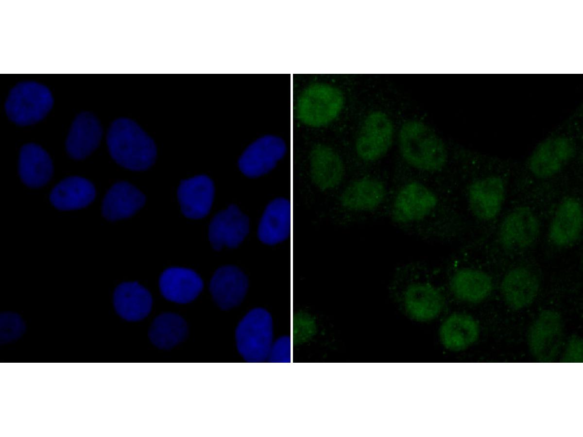 ICC staining of PDK1 in NIH/3T3 cells (green). Formalin fixed cells were permeabilized with 0.1% Triton X-100 in TBS for 10 minutes at room temperature and blocked with 1% Blocker BSA for 15 minutes at room temperature. Cells were probed with the primary antibody (ET1704-66, 1/50) for 1 hour at room temperature, washed with PBS. Alexa Fluor®488 Goat anti-Rabbit IgG was used as the secondary antibody at 1/1,000 dilution. The nuclear counter stain is DAPI (blue).