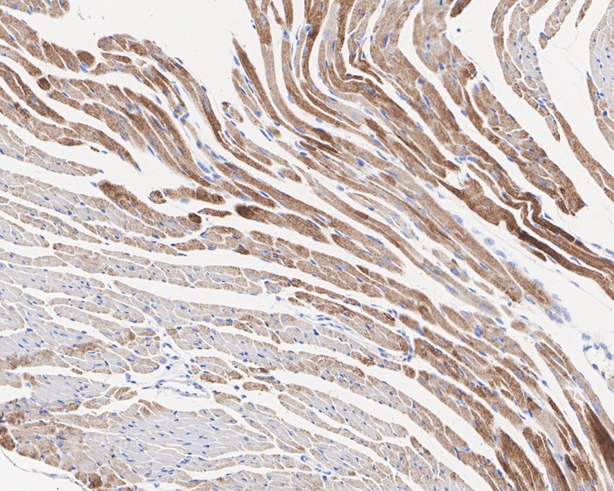 Immunohistochemical analysis of paraffin-embedded mouse heart tissue using anti-PDK1 antibody. The section was pre-treated using heat mediated antigen retrieval with Tris-EDTA buffer (pH 8.0-8.4) for 20 minutes.The tissues were blocked in 5% BSA for 30 minutes at room temperature, washed with ddH2O and PBS, and then probed with the primary antibody (ET1704-66, 1/50) for 30 minutes at room temperature. The detection was performed using an HRP conjugated compact polymer system. DAB was used as the chromogen. Tissues were counterstained with hematoxylin and mounted with DPX.