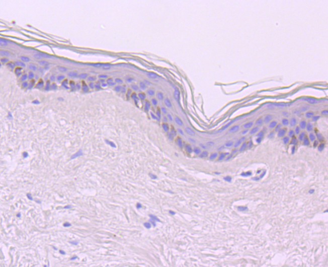 Immunohistochemical analysis of paraffin-embedded human skin tissue using anti-CDT1 antibody. The section was pre-treated using heat mediated antigen retrieval with Tris-EDTA buffer (pH 9.0) for 20 minutes.The tissues were blocked in 1% BSA for 30 minutes at room temperature, washed with ddH2O and PBS, and then probed with the primary antibody (ET1704-67, 1/50) for 30 minutes at room temperature. The detection was performed using an HRP conjugated compact polymer system. DAB was used as the chromogen. Tissues were counterstained with hematoxylin and mounted with DPX.