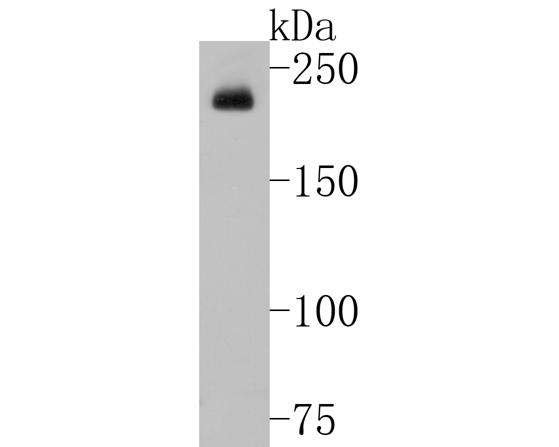 Western blot analysis of GCN2 on SKOV-3 cell lysates. Proteins were transferred to a PVDF membrane and blocked with 5% BSA in PBS for 1 hour at room temperature. The primary antibody (ET1704-68, 1/500) was used in 5% BSA at room temperature for 2 hours. Goat Anti-Rabbit IgG - HRP Secondary Antibody (HA1001) at 1:5,000 dilution was used for 1 hour at room temperature.