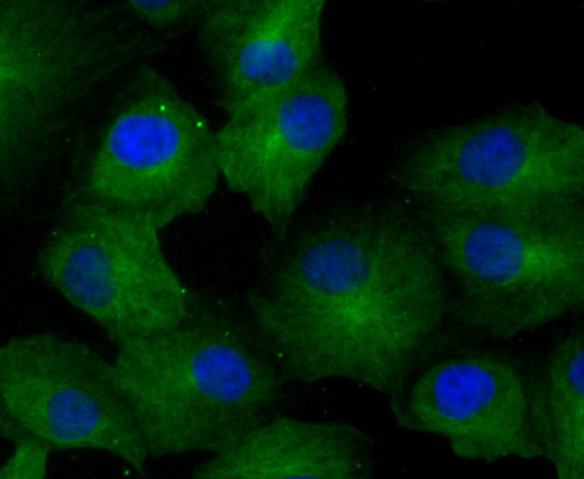 ICC staining of GCN2 in Hela cells (green). Formalin fixed cells were permeabilized with 0.1% Triton X-100 in TBS for 10 minutes at room temperature and blocked with 1% Blocker BSA for 15 minutes at room temperature. Cells were probed with the primary antibody (ET1704-68, 1/50) for 1 hour at room temperature, washed with PBS. Alexa Fluor®488 Goat anti-Rabbit IgG was used as the secondary antibody at 1/1,000 dilution. The nuclear counter stain is DAPI (blue).