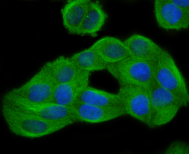 ICC staining of GCN2 in MCF-7 cells (green). Formalin fixed cells were permeabilized with 0.1% Triton X-100 in TBS for 10 minutes at room temperature and blocked with 1% Blocker BSA for 15 minutes at room temperature. Cells were probed with the primary antibody (ET1704-68, 1/50) for 1 hour at room temperature, washed with PBS. Alexa Fluor®488 Goat anti-Rabbit IgG was used as the secondary antibody at 1/1,000 dilution. The nuclear counter stain is DAPI (blue).