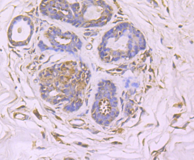 Immunohistochemical analysis of paraffin-embedded human placenta tissue using anti-GCN2 antibody. The section was pre-treated using heat mediated antigen retrieval with Tris-EDTA buffer (pH 8.0-8.4) for 20 minutes.The tissues were blocked in 5% BSA for 30 minutes at room temperature, washed with ddH2O and PBS, and then probed with the primary antibody (ET1704-68, 1/50) for 30 minutes at room temperature. The detection was performed using an HRP conjugated compact polymer system. DAB was used as the chromogen. Tissues were counterstained with hematoxylin and mounted with DPX.