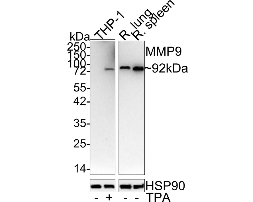 Western blot analysis of MMP9 on rat spleen tissue lysates. Proteins were transferred to a PVDF membrane and blocked with 5% BSA in PBS for 1 hour at room temperature. The primary antibody (ET1704-69, 1/500) was used in 5% BSA at room temperature for 2 hours. Goat Anti-Rabbit IgG - HRP Secondary Antibody (HA1001) at 1:5,000 dilution was used for 1 hour at room temperature.