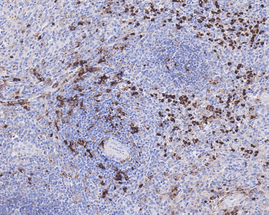 Immunohistochemical analysis of paraffin-embedded human tonsil tissue using anti-MMP9 antibody. The section was pre-treated using heat mediated antigen retrieval with Tris-EDTA buffer (pH 8.0-8.4) for 20 minutes.The tissues were blocked in 5% BSA for 30 minutes at room temperature, washed with ddH2O and PBS, and then probed with the primary antibody (ET1704-69, 1/50) for 30 minutes at room temperature. The detection was performed using an HRP conjugated compact polymer system. DAB was used as the chromogen. Tissues were counterstained with hematoxylin and mounted with DPX.