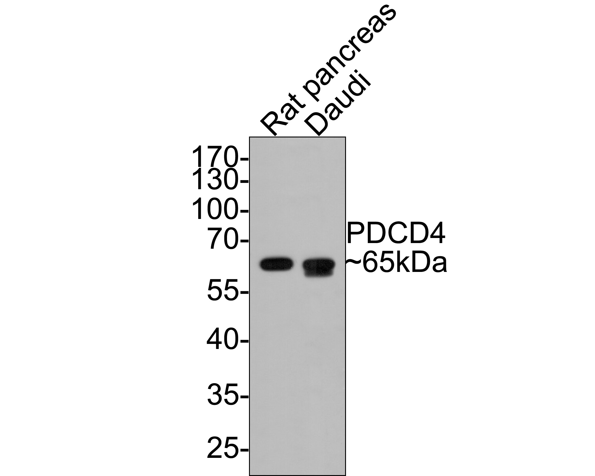 ICC staining PDCD4 in A431 cells (green). The nuclear counter stain is DAPI (blue). Cells were fixed in paraformaldehyde, permeabilised with 0.25% Triton X100/PBS.