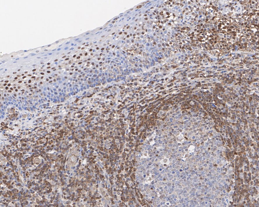 Immunohistochemical analysis of paraffin-embedded human tonsil tissue using anti-PDCD4 antibody. Counter stained with hematoxylin.
