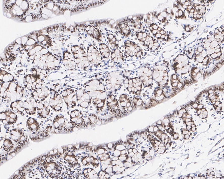 Immunohistochemical analysis of paraffin-embedded human prostate tissue using anti-PDCD4 antibody. Counter stained with hematoxylin.