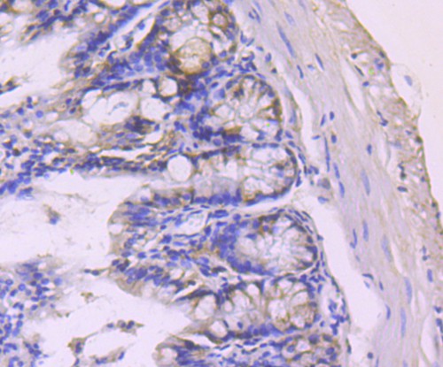 Immunohistochemical analysis of paraffin-embedded mouse colon tissue using anti-PDCD4 antibody. Counter stained with hematoxylin.