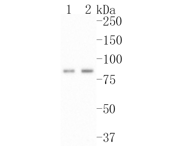 Immunohistochemical analysis of paraffin-embedded human fetal skeletal muscle tissue using anti-Bag3 antibody. The section was pre-treated using heat mediated antigen retrieval with Tris-EDTA buffer (pH 8.0-8.4) for 20 minutes.The tissues were blocked in 5% BSA for 30 minutes at room temperature, washed with ddH2O and PBS, and then probed with the primary antibody (ET1704-73, 1/50) for 30 minutes at room temperature. The detection was performed using an HRP conjugated compact polymer system. DAB was used as the chromogen. Tissues were counterstained with hematoxylin and mounted with DPX.