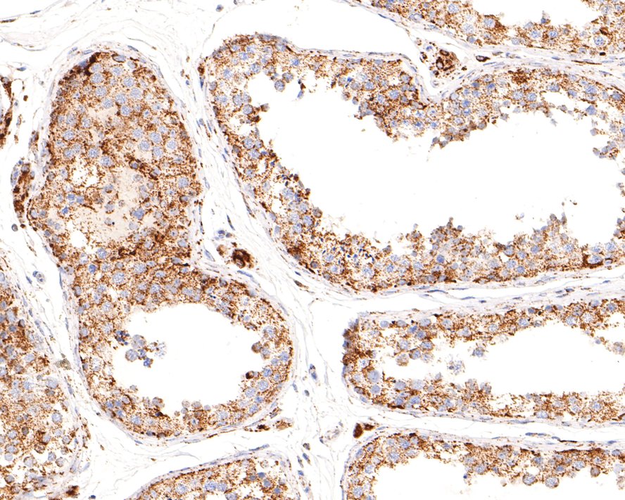 Immunohistochemical analysis of paraffin-embedded rat testis tissue using anti-DAZL antibody. The section was pre-treated using heat mediated antigen retrieval with Tris-EDTA buffer (pH 9.0) for 20 minutes.The tissues were blocked in 1% BSA for 30 minutes at room temperature, washed with ddH2O and PBS, and then probed with the primary antibody (ET1704-75, 1/50) for 30 minutes at room temperature. The detection was performed using an HRP conjugated compact polymer system. DAB was used as the chromogen. Tissues were counterstained with hematoxylin and mounted with DPX.