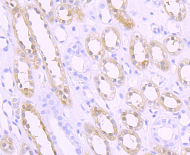 Immunohistochemical analysis of paraffin-embedded human kidney tissue using anti-SPHK1 antibody. The section was pre-treated using heat mediated antigen retrieval with Tris-EDTA buffer (pH 8.0-8.4) for 20 minutes.The tissues were blocked in 5% BSA for 30 minutes at room temperature, washed with ddH2O and PBS, and then probed with the primary antibody (ET1704-76, 1/50) for 30 minutes at room temperature. The detection was performed using an HRP conjugated compact polymer system. DAB was used as the chromogen. Tissues were counterstained with hematoxylin and mounted with DPX.