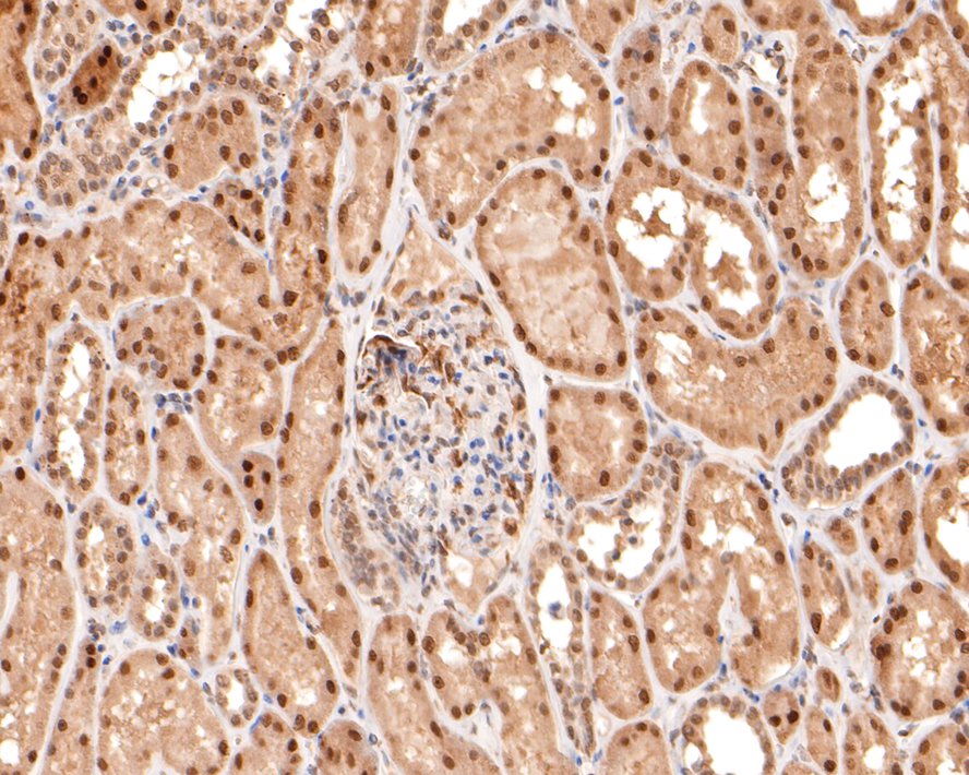 Immunohistochemical analysis of paraffin-embedded human kidney tissue with Rabbit anti-OGG1 antibody (ET1704-79) at 1/400 dilution.<br />
<br />
The section was pre-treated using heat mediated antigen retrieval with sodium citrate buffer (pH 6.0) for 2 minutes. The tissues were blocked in 1% BSA for 20 minutes at room temperature, washed with ddH2O and PBS, and then probed with the primary antibody (ET1704-79) at 1/400 dilution for 1 hour at room temperature. The detection was performed using an HRP conjugated compact polymer system. DAB was used as the chromogen. Tissues were counterstained with hematoxylin and mounted with DPX.