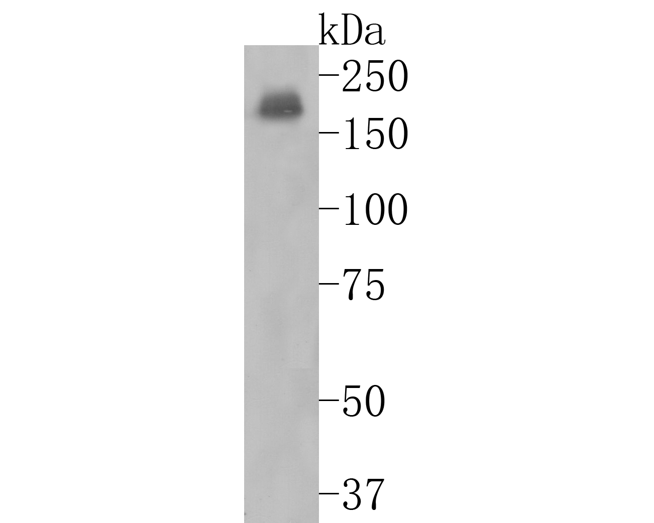 Western blot analysis of NMDAR2A on mouse hippocampus tissue lysates. Proteins were transferred to a PVDF membrane and blocked with 5% BSA in PBS for 1 hour at room temperature. The primary antibody (ET1704-80, 1/500) was used in 5% BSA at room temperature for 2 hours. Goat Anti-Rabbit IgG - HRP Secondary Antibody (HA1001) at 1:5,000 dilution was used for 1 hour at room temperature.