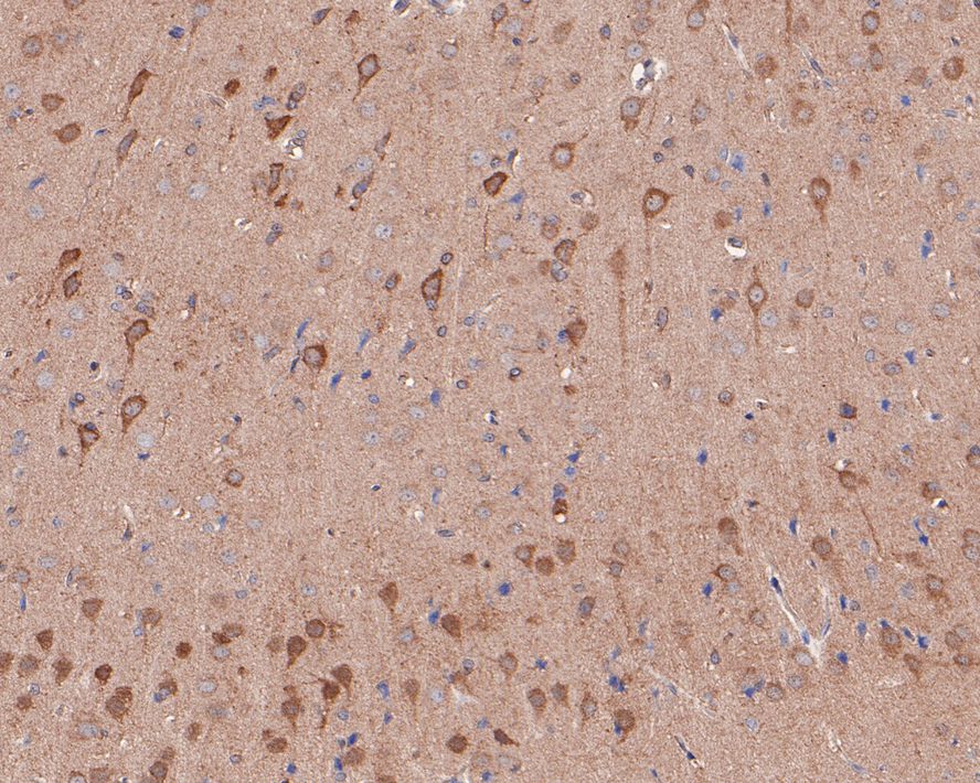 Immunohistochemical analysis of paraffin-embedded rat brain tissue with Rabbit anti-NMDAR2A antibody (ET1704-80) at 1/50 dilution.<br />
<br />
The section was pre-treated using heat mediated antigen retrieval with Tris-EDTA buffer (pH 9.0) for 20 minutes. The tissues were blocked in 1% BSA for 20 minutes at room temperature, washed with ddH2O and PBS, and then probed with the primary antibody (ET1704-80) at 1/50 dilution for 1 hour at room temperature. The detection was performed using an HRP conjugated compact polymer system. DAB was used as the chromogen. Tissues were counterstained with hematoxylin and mounted with DPX.