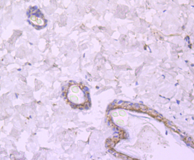 Immunohistochemical analysis of paraffin-embedded rat skin tissue using anti-NMDAR2A antibody. Counter stained with hematoxylin.