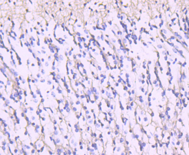 Immunohistochemical analysis of paraffin-embedded human brain tissue using anti-NMDAR2A antibody. Counter stained with hematoxylin.