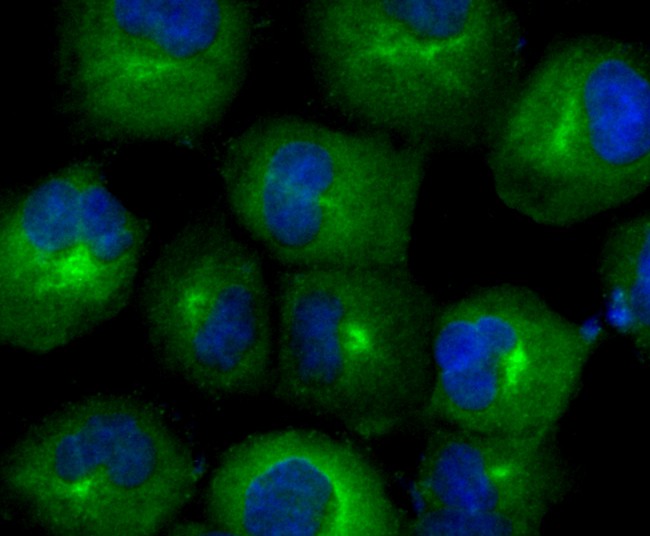 ICC staining of TXNRD1 in HUVEC cells (green). Formalin fixed cells were permeabilized with 0.1% Triton X-100 in TBS for 10 minutes at room temperature and blocked with 1% Blocker BSA for 15 minutes at room temperature. Cells were probed with the primary antibody (ET1704-81, 1/50) for 1 hour at room temperature, washed with PBS. Alexa Fluor®488 Goat anti-Rabbit IgG was used as the secondary antibody at 1/1,000 dilution. The nuclear counter stain is DAPI (blue).