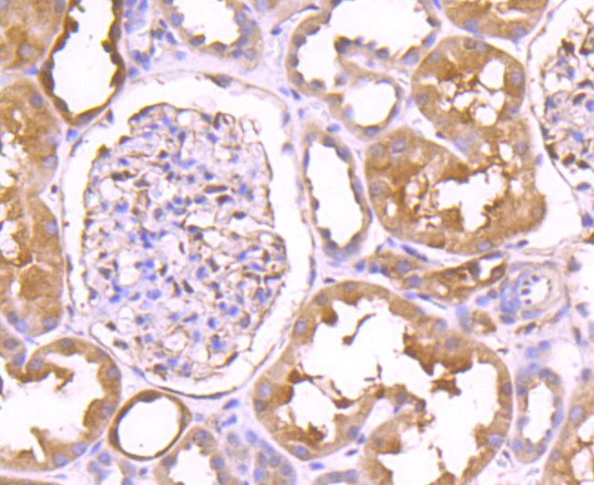 Immunohistochemical analysis of paraffin-embedded human kidney tissue using anti-TXNRD1 antibody. The section was pre-treated using heat mediated antigen retrieval with Tris-EDTA buffer (pH 8.0-8.4) for 20 minutes.The tissues were blocked in 5% BSA for 30 minutes at room temperature, washed with ddH2O and PBS, and then probed with the primary antibody (ET1704-81, 1/50) for 30 minutes at room temperature. The detection was performed using an HRP conjugated compact polymer system. DAB was used as the chromogen. Tissues were counterstained with hematoxylin and mounted with DPX.