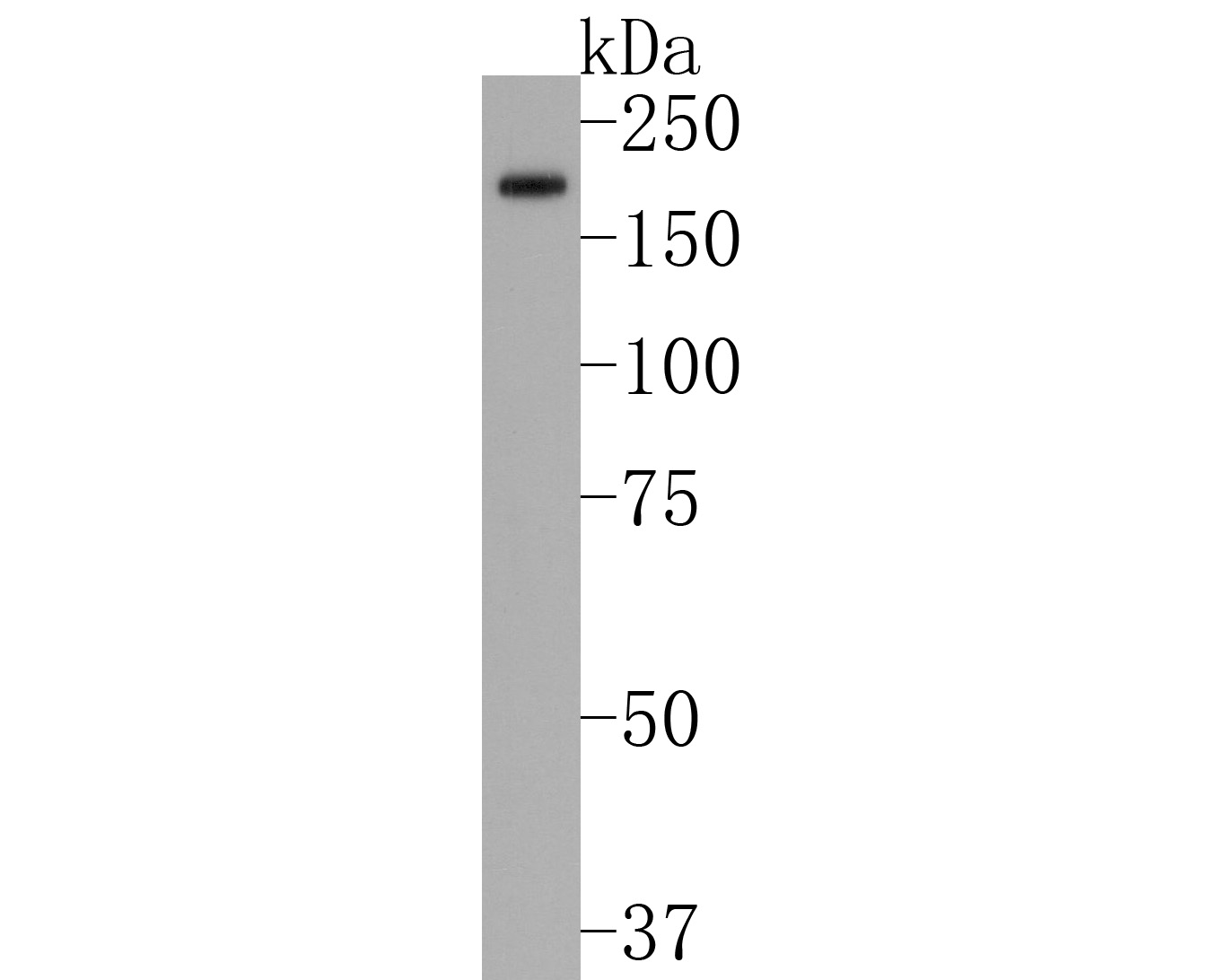 Western blot analysis of Factor H on human kidney tissue lysates. Proteins were transferred to a PVDF membrane and blocked with 5% BSA in PBS for 1 hour at room temperature. The primary antibody (ET1704-83, 1/500) was used in 5% BSA at room temperature for 2 hours. Goat Anti-Rabbit IgG - HRP Secondary Antibody (HA1001) at 1:200,000 dilution was used for 1 hour at room temperature.