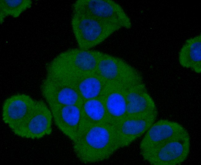 ICC staining of Factor H in Hela cells (green). Formalin fixed cells were permeabilized with 0.1% Triton X-100 in TBS for 10 minutes at room temperature and blocked with 1% Blocker BSA for 15 minutes at room temperature. Cells were probed with the primary antibody (ET1704-83, 1/50) for 1 hour at room temperature, washed with PBS. Alexa Fluor®488 Goat anti-Rabbit IgG was used as the secondary antibody at 1/1,000 dilution. The nuclear counter stain is DAPI (blue).