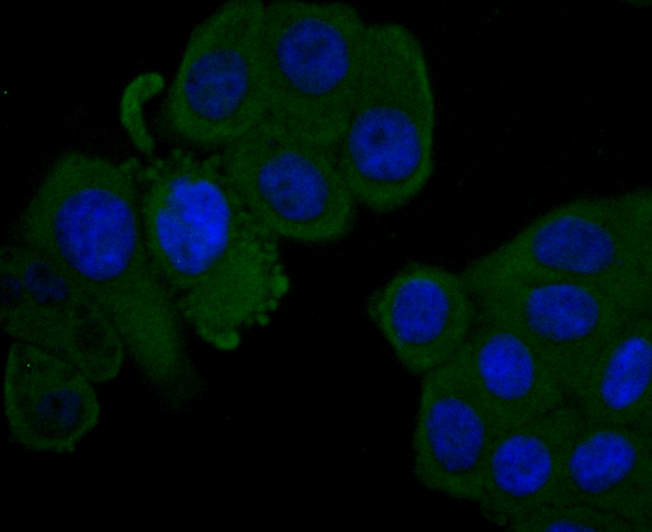 ICC staining of Factor H in HepG2 cells (green). Formalin fixed cells were permeabilized with 0.1% Triton X-100 in TBS for 10 minutes at room temperature and blocked with 1% Blocker BSA for 15 minutes at room temperature. Cells were probed with the primary antibody (ET1704-83, 1/50) for 1 hour at room temperature, washed with PBS. Alexa Fluor®488 Goat anti-Rabbit IgG was used as the secondary antibody at 1/1,000 dilution. The nuclear counter stain is DAPI (blue).