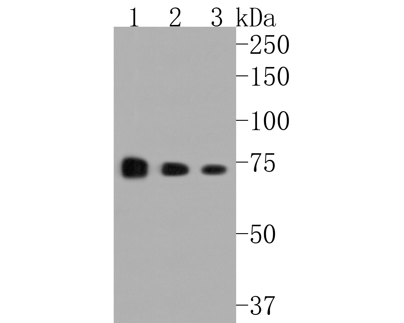 Western blot analysis of PKC epsilon on different lysates. Proteins were transferred to a PVDF membrane and blocked with 5% BSA in PBS for 1 hour at room temperature. The primary antibody (ET1704-85, 1/500) was used in 5% BSA at room temperature for 2 hours. Goat Anti-Rabbit IgG - HRP Secondary Antibody (HA1001) at 1:5,000 dilution was used for 1 hour at room temperature.<br />
Positive control: <br />
Lane 1: MCF-7 cell lysate<br />
Lane 2: Jurkat cell lysate<br />
Lane 3: HT-29 cell lysate