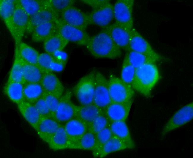 ICC staining of PKC epsilon in 293T cells (green). Formalin fixed cells were permeabilized with 0.1% Triton X-100 in TBS for 10 minutes at room temperature and blocked with 1% Blocker BSA for 15 minutes at room temperature. Cells were probed with the primary antibody (ET1704-85, 1/50) for 1 hour at room temperature, washed with PBS. Alexa Fluor®488 Goat anti-Rabbit IgG was used as the secondary antibody at 1/1,000 dilution. The nuclear counter stain is DAPI (blue).