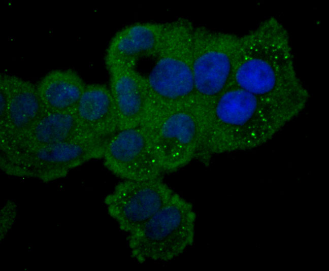 ICC staining of PKC epsilon in Hela cells (green). Formalin fixed cells were permeabilized with 0.1% Triton X-100 in TBS for 10 minutes at room temperature and blocked with 1% Blocker BSA for 15 minutes at room temperature. Cells were probed with the primary antibody (ET1704-85, 1/50) for 1 hour at room temperature, washed with PBS. Alexa Fluor®488 Goat anti-Rabbit IgG was used as the secondary antibody at 1/1,000 dilution. The nuclear counter stain is DAPI (blue).