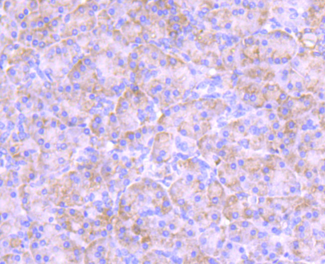 Immunohistochemical analysis of paraffin-embedded human pancreas tissue using anti-PKC epsilon antibody. The section was pre-treated using heat mediated antigen retrieval with Tris-EDTA buffer (pH 8.0-8.4) for 20 minutes.The tissues were blocked in 5% BSA for 30 minutes at room temperature, washed with ddH2O and PBS, and then probed with the primary antibody (ET1704-85, 1/50) for 30 minutes at room temperature. The detection was performed using an HRP conjugated compact polymer system. DAB was used as the chromogen. Tissues were counterstained with hematoxylin and mounted with DPX.