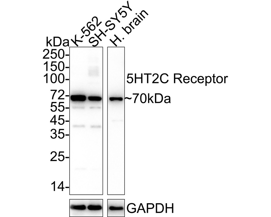 Western blot analysis of 5HT2C Receptor on different lysates with Rabbit anti-5HT2C Receptor antibody (ET1704-87) at 1/500 dilution.<br />
<br />
Lane 1: K562 cell lysate<br />
Lane 2: A431 cell lysate<br />
<br />
Lysates/proteins at 10 µg/Lane.<br />
<br />
Predicted band size: 52 kDa<br />
Observed band size: 70 kDa<br />
<br />
Exposure time: 2 minutes;<br />
<br />
8% SDS-PAGE gel.<br />
<br />
Proteins were transferred to a PVDF membrane and blocked with 5% NFDM/TBST for 1 hour at room temperature. The primary antibody (ET1704-87) at 1/500 dilution was used in 5% NFDM/TBST at room temperature for 2 hours. Goat Anti-Rabbit IgG - HRP Secondary Antibody (HA1001) at 1:300,000 dilution was used for 1 hour at room temperature.