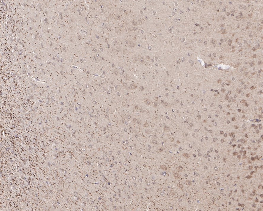 Immunohistochemical analysis of paraffin-embedded mouse brain tissue using anti-5HT2C Receptor antibody. The section was pre-treated using heat mediated antigen retrieval with Tris-EDTA buffer (pH 8.0-8.4) for 20 minutes.The tissues were blocked in 5% BSA for 30 minutes at room temperature, washed with ddH2O and PBS, and then probed with the primary antibody (ET1704-87, 1/50) for 30 minutes at room temperature. The detection was performed using an HRP conjugated compact polymer system. DAB was used as the chromogen. Tissues were counterstained with hematoxylin and mounted with DPX.