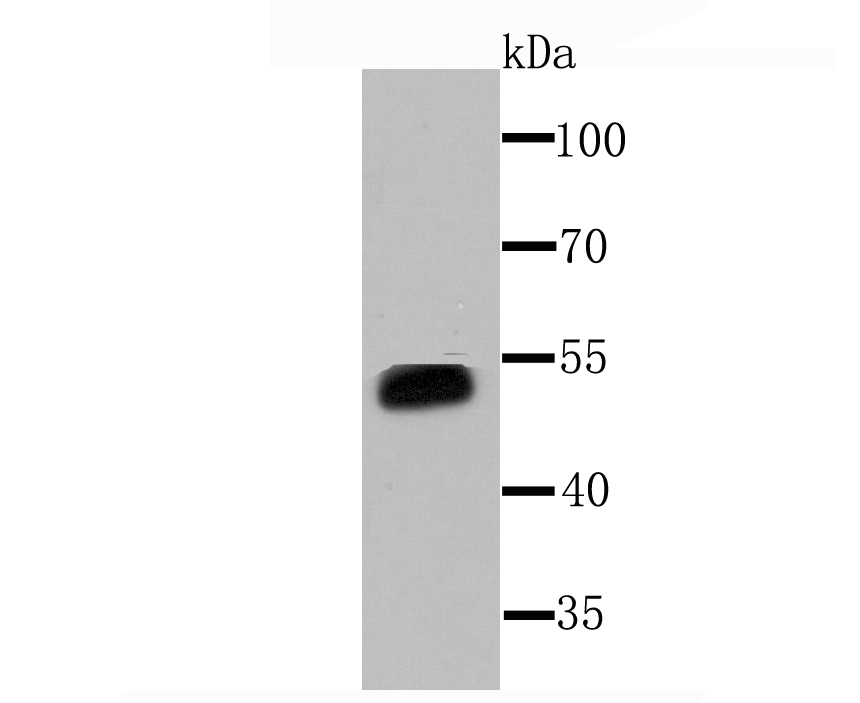 Western blot analysis of Cytochrome P450 3A4 on human liver tissue lysate using anti-Cytochrome P450 3A4 antibody at 1/1,000 dilution.