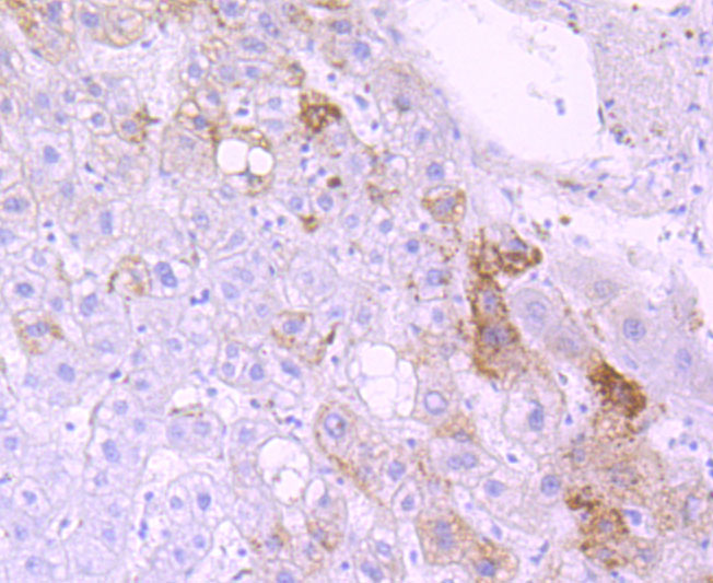 Immunohistochemical analysis of paraffin-embedded human liver tissue using anti-Cytochrome P450 3A4 antibody. Counter stained with hematoxylin.