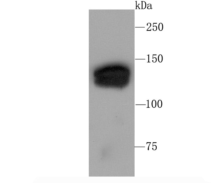 Western blot analysis of mSin3A on 293T cell lysates. Proteins were transferred to a PVDF membrane and blocked with 5% BSA in PBS for 1 hour at room temperature. The primary antibody (ET1704-91, 1/500) was used in 5% BSA at room temperature for 2 hours. Goat Anti-Rabbit IgG - HRP Secondary Antibody (HA1001) at 1:200,000 dilution was used for 1 hour at room temperature.