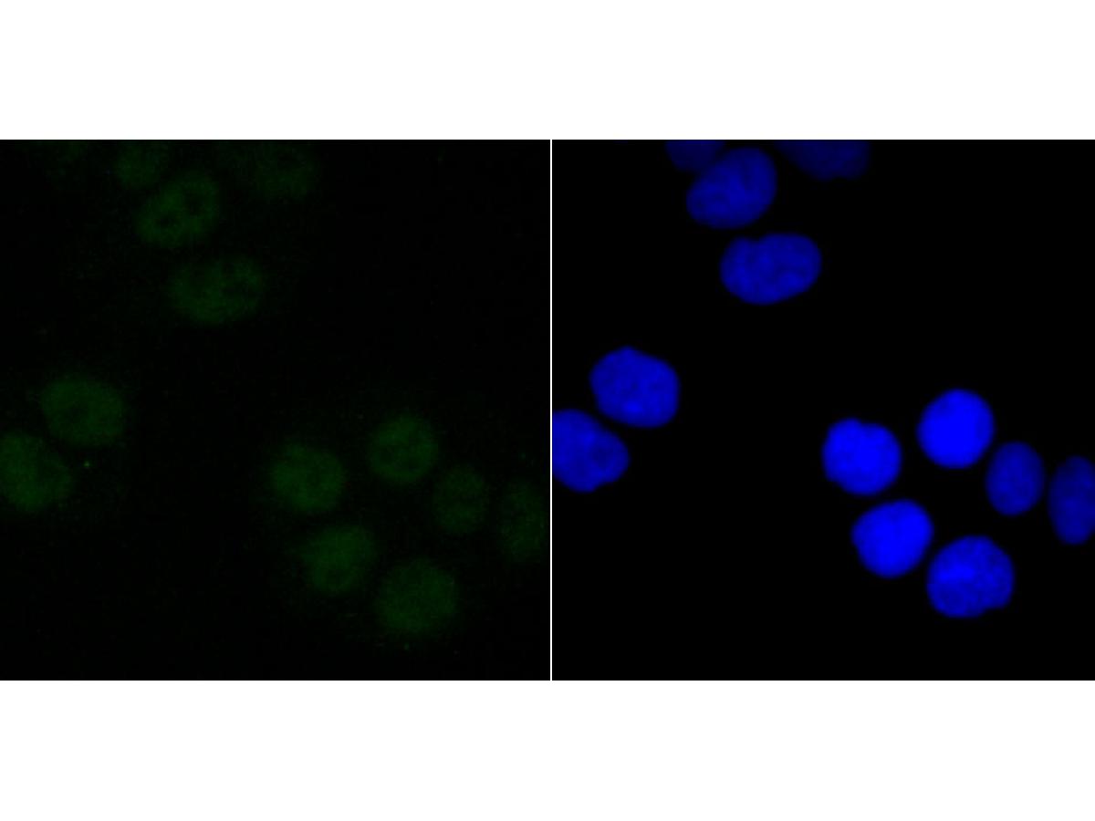 ICC staining of mSin3A in Hela cells (green). Formalin fixed cells were permeabilized with 0.1% Triton X-100 in TBS for 10 minutes at room temperature and blocked with 10% negative goat serum for 15 minutes at room temperature. Cells were probed with the primary antibody (ET1704-91, 1/50) for 1 hour at room temperature, washed with PBS. Alexa Fluor®488 conjugate-Goat anti-Rabbit IgG was used as the secondary antibody at 1/1,000 dilution. The nuclear counter stain is DAPI (blue).