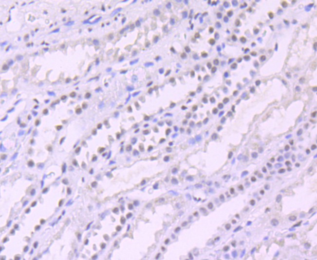 Immunohistochemical analysis of paraffin-embedded human kidney tissue using anti-mSin3A antibody. The section was pre-treated using heat mediated antigen retrieval with Tris-EDTA buffer (pH 9.0) for 20 minutes.The tissues were blocked in 1% BSA for 30 minutes at room temperature, washed with ddH2O and PBS, and then probed with the primary antibody (ET1704-91, 1/50) for 30 minutes at room temperature. The detection was performed using an HRP conjugated compact polymer system. DAB was used as the chromogen. Tissues were counterstained with hematoxylin and mounted with DPX.