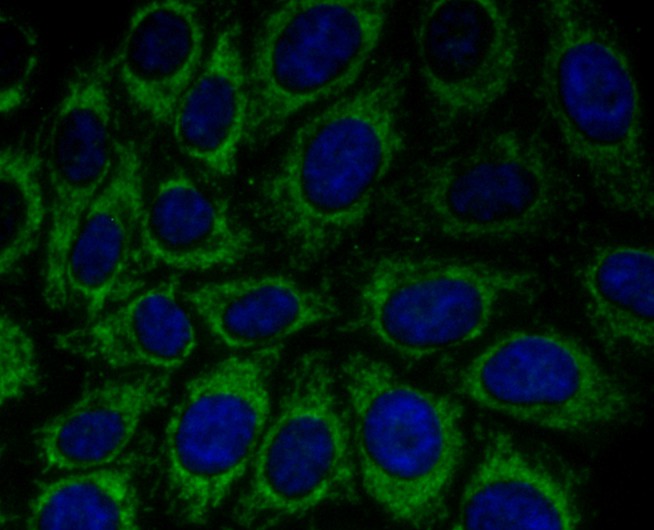 ICC staining of Peroxiredoxin 3 in HepG2 cells (green). Formalin fixed cells were permeabilized with 0.1% Triton X-100 in TBS for 10 minutes at room temperature and blocked with 10% negative goat serum for 15 minutes at room temperature. Cells were probed with the primary antibody (ET1704-92, 1/50) for 1 hour at room temperature, washed with PBS. Alexa Fluor®488 conjugate-Goat anti-Rabbit IgG was used as the secondary antibody at 1/1,000 dilution. The nuclear counter stain is DAPI (blue).